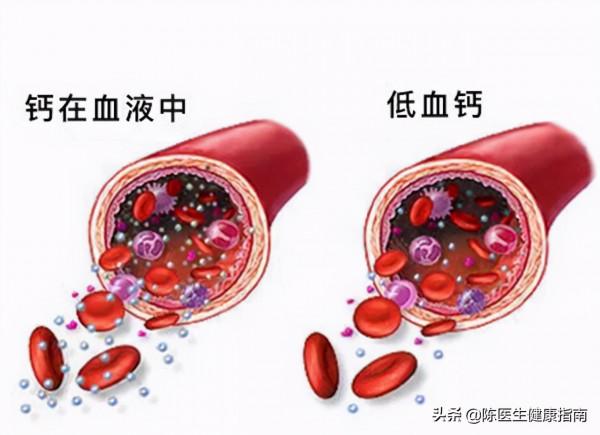 老人腿抽筋真的是因為缺鈣嗎？闢謠：小腿痙攣，警惕2種疾病