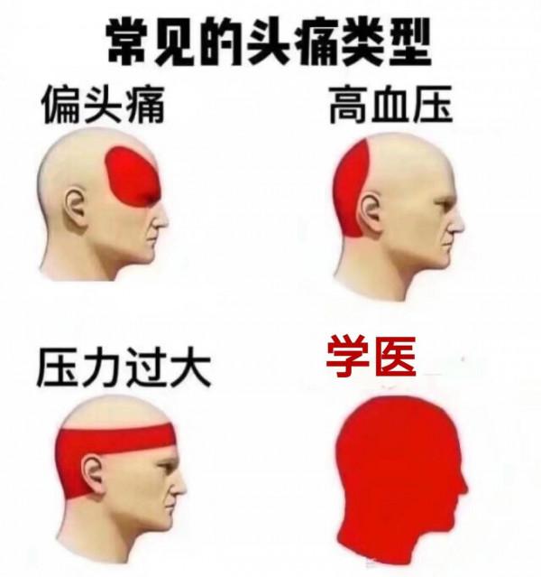 浙江中醫學院陸藏青教授偏頭痛方