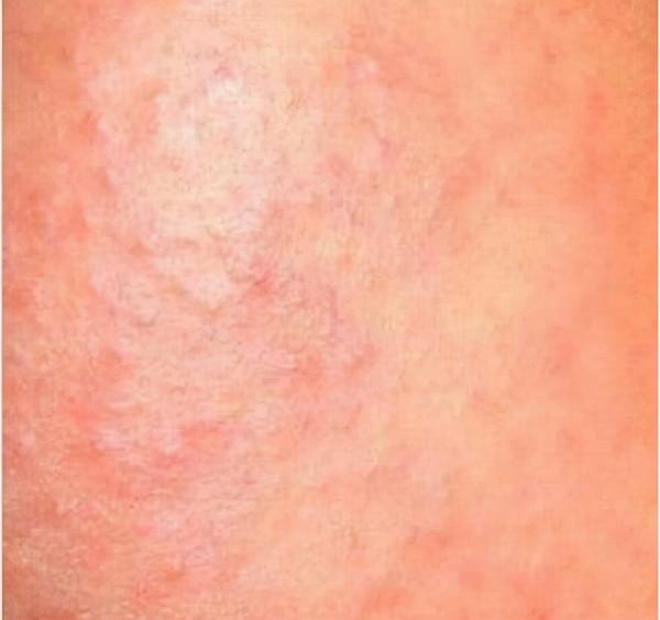 面板突然開小差,請注意以下幾點 面板突然開小差,請注意以下幾點