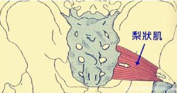 腰疼腿麻可不一定是腰脫，也許是這塊肌肉出問題？