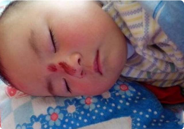 孩子墜床後，媽媽第一步要做的不是“立馬抱起”，正確做法要記住