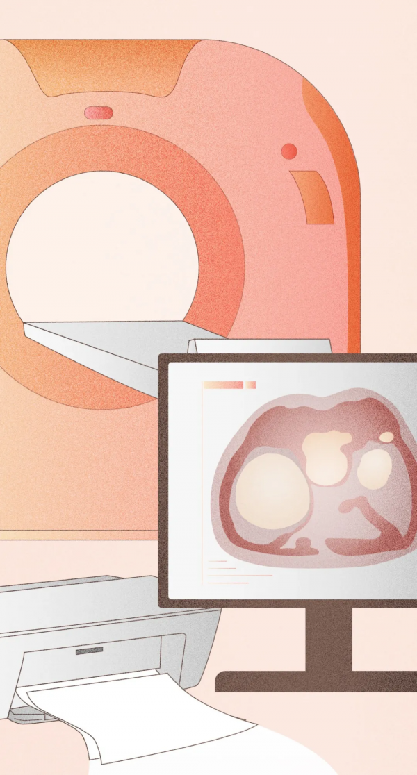 囊腫和腫瘤，「腫」的一樣嗎？