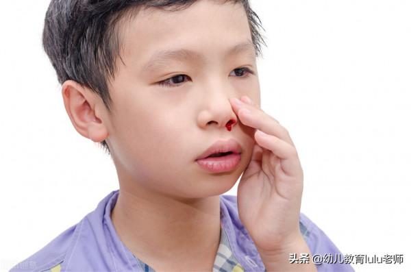 秋冬季孩子鼻子總出血,家長該如何應對? 秋冬季孩子鼻子總出血,家長該如何應對?