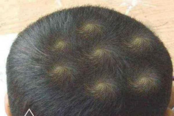 孩子的頭頂有兩個“旋”暗示更聰明?一個科學實驗告訴你答案 孩子的頭頂有兩個“旋”暗示更聰明?一個科學實驗告訴你答案