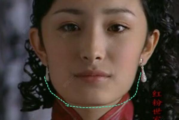 那些一刀切削骨的明星還好嗎?後遺症一大堆,小方臉成最大贏家 那些一刀切削骨的明星還好嗎?後遺症一大堆,小方臉成最大贏家