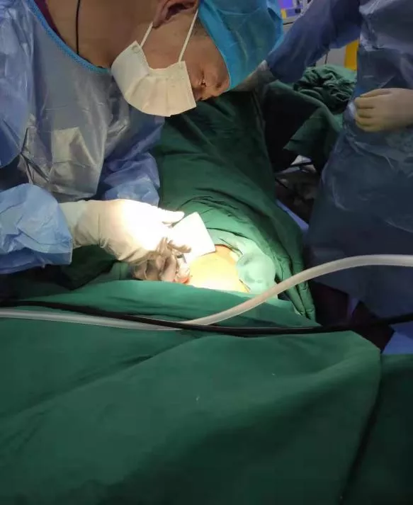 無痛內科胸腔鏡解鎖胸腔積液謎團