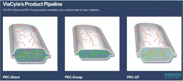 治癒糖尿病的新希望:胰島細胞封裝術 治癒糖尿病的新希望:胰島細胞封裝術