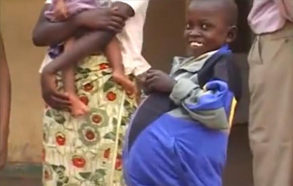 非洲醫院做手術，醫生就到點直接下班了