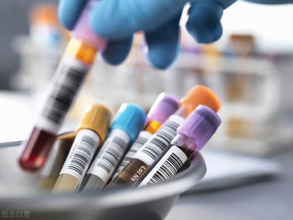 為什麼肝癌早期診斷要查甲胎蛋白?升高意味著肝癌嗎?真不一定 為什麼肝癌早期診斷要查甲胎蛋白?升高意味著肝癌嗎?真不一定