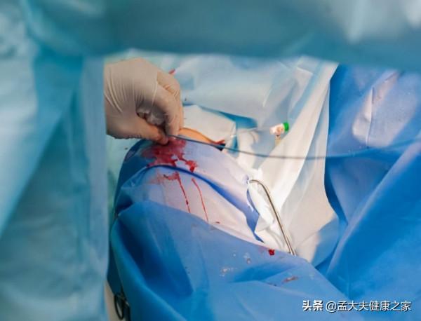 長期服用阿司匹林和他汀，是在治療腦梗死嗎，真正目的是什麼？