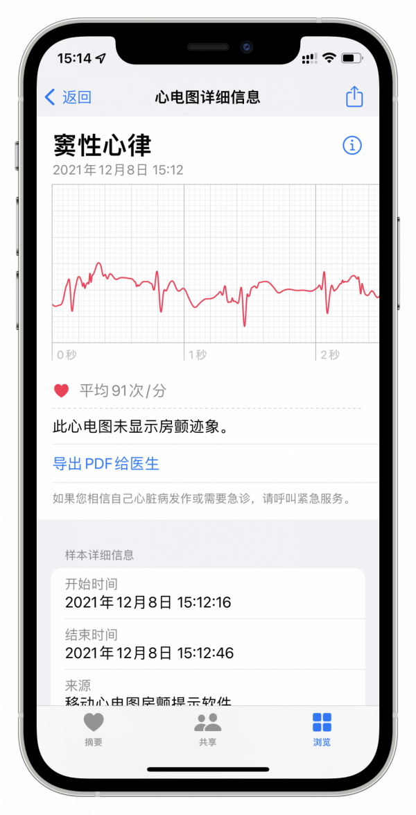 iOS 15.2新功能總結與更新建議,心電圖、隱私報告正式上線 iOS 15.2新功能總結與更新建議,心電圖、隱私報告正式上線