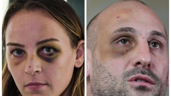 法國柔道冠軍妹子控告男友家暴，男友不服：看我都被揍成啥樣了