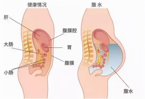 促排取卵時，醫生建議的“高蛋白飲食”到底怎麼吃？