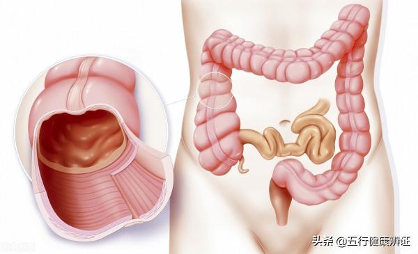 經常便秘，可能是腸道出了問題，6個因素是主因，不妨自查一下
