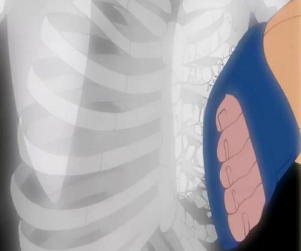 邁特凱為何不移植右腿，害怕被細胞吞噬？看到繃帶上的字明白了