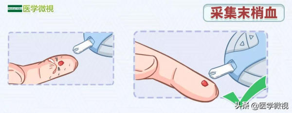 自己在家監測血糖，應該扎哪個手指？