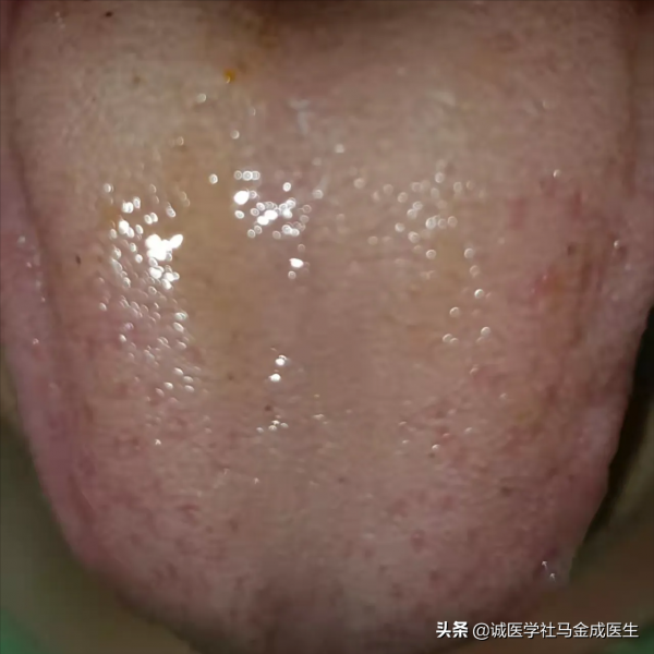 脾虛，溼熱盛，送你三味藥，一味健脾、一味清熱、一味祛溼