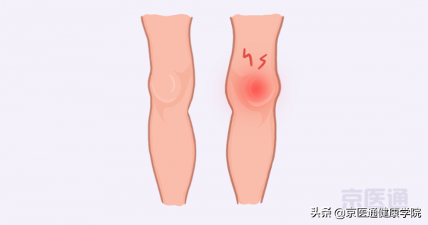 膝蓋疼、腿疼、腳疼,5種跑步損傷,專家教你處理 膝蓋疼、腿疼、腳疼,5種跑步損傷,專家教你處理