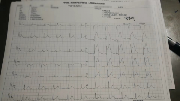 經常熬夜、吃外賣，24歲“老煙槍”玩遊戲突發心梗險喪命