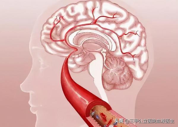 冬季來臨 患有心血管疾病中老年人 在晨起的時候 需要注意哪些事項？