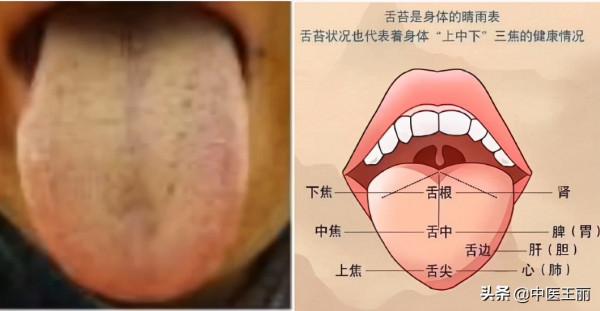 最近整理了一些粉絲的舌診分析，大家可以看看（每日舌象分析）
