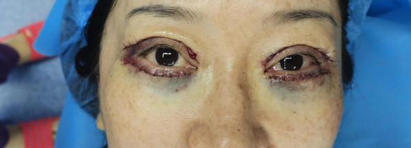 作為整形醫生，該不該整形，我給你怎麼的建議？