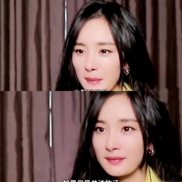 楊冪&OpenCurlyDoubleQuote;拔牙後遺症&rdquo;犯了！打臉說整容的人，粉絲：這毛病可以接受