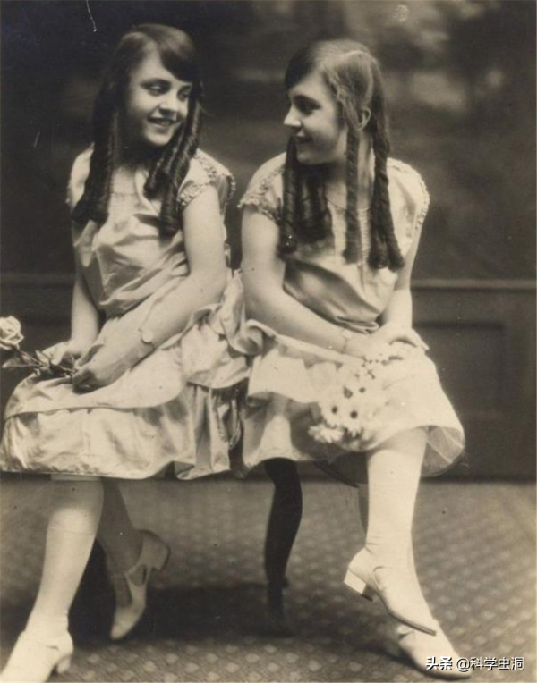 連體人一個去世怎麼辦？連體姐姐死後，妹妹被迫和遺骸生存2天