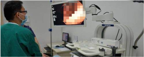 無痛腸鏡檢查中，患者突然大量嘔吐，醫生用一根塑膠管救了他一命