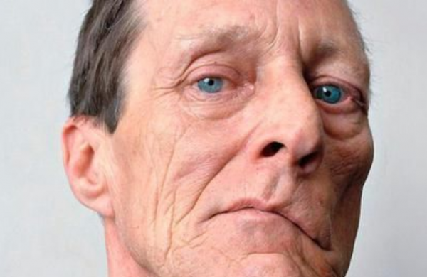 腦供血不足時，身上或會有這幾個表現，建議日常多留意