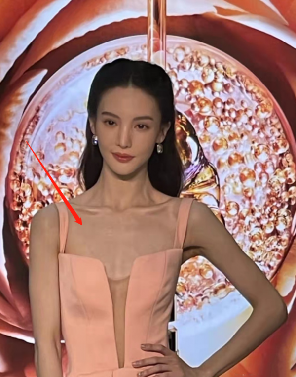 明星經紀人曝快速減肥的代價：瘦得脫相，眼神不聚焦，面板狀態差