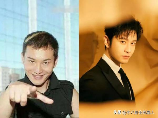 明星&OpenCurlyDoubleQuote;禿頂&rdquo;群像，中年男星頭頂稀疏成重災區，女星靠假髮片社交