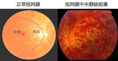 科學家：從你的眼睛裡，能預測出你早死的機率