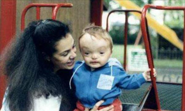 英國男子臉部畸形，憑魅力迎娶美女大學生，孩子出生後笑不出來了