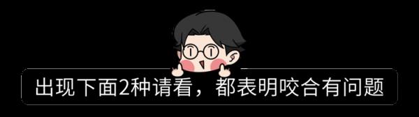 為什麼只要戴牙套,牙齒就可以恢復得很整齊?生動展示矯正過程 為什麼只要戴牙套,牙齒就可以恢復得很整齊?生動展示矯正過程