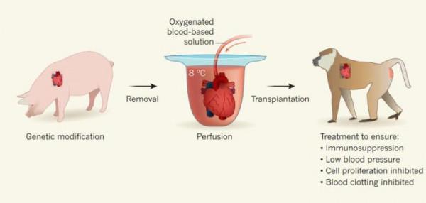 天目Tech+豬心臟移植到患者身上？心臟外科專家：意義重大