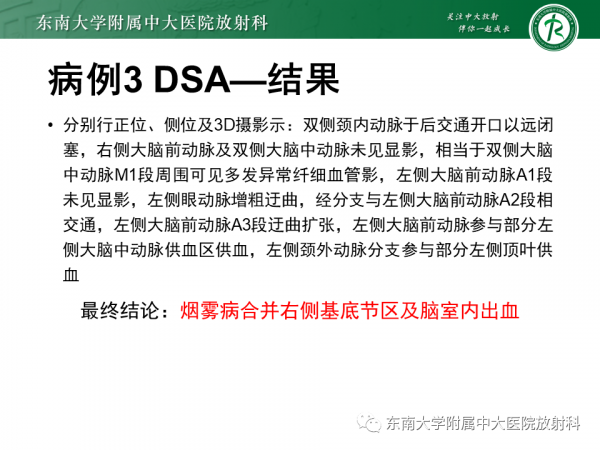 腦動靜脈畸形影像學特徵