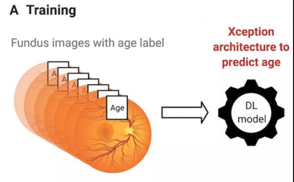 科學家：從你的眼睛裡，能預測出你早死的機率