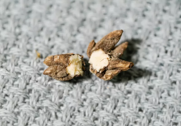 一味藥煮水治療結節,乳腺結節、肺結節、皮下結節均可一試 一味藥煮水治療結節,乳腺結節、肺結節、皮下結節均可一試