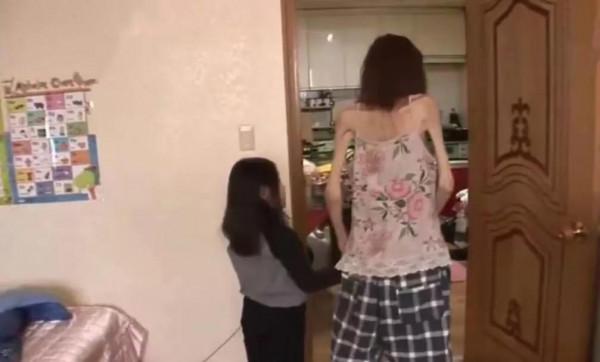 韓國女人瘦到皮包骨頭，生活無法自理，年輕時卻是大美人