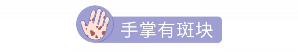 身體好不好，看手就知道？一文教你從手上看出身體狀況，附對比圖