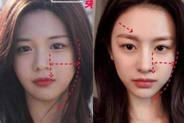 韓流明星整容堪比換頭:蔡妍換臉成功,任娜英李鍾碩鼻子變形 韓流明星整容堪比換頭:蔡妍換臉成功,任娜英李鍾碩鼻子變形