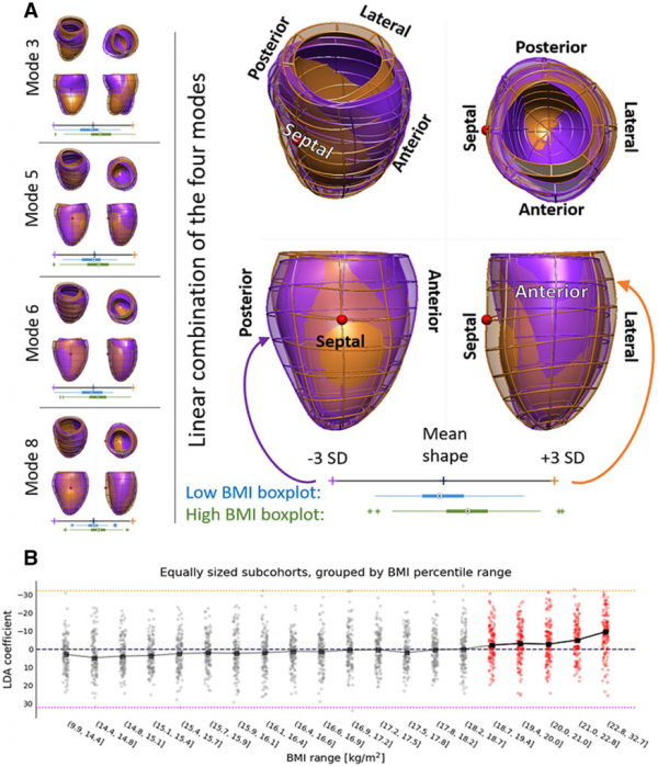 研究首次揭示肥胖對兒童心臟解剖結構的影響