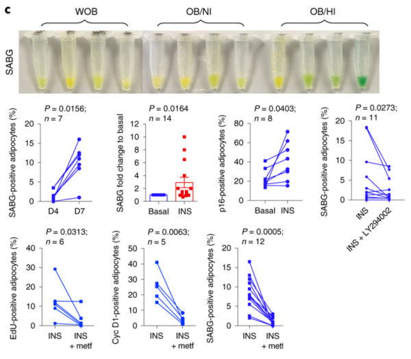 《自然·醫學》:脂肪細胞“長胖”200倍的機制找到了!科學家首次發現,脂肪細胞竟然也可進入細胞週期丨科學大發現 《自然·醫學》:脂肪細胞“長胖”200倍的機制找到了!科學家首次發現,脂肪細胞竟然也可進入細胞週期丨科學大發現