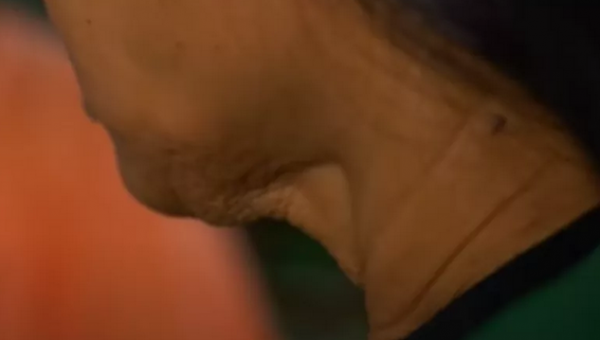 菲律賓女孩14歲參加選美，2年內滿臉皺紋，外表像60歲比她媽還老