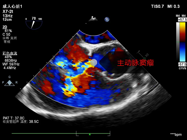 30歲小夥多次發燒胸悶,竟是心臟出了問題!醫生:別不當回事 30歲小夥多次發燒胸悶,竟是心臟出了問題!醫生:別不當回事