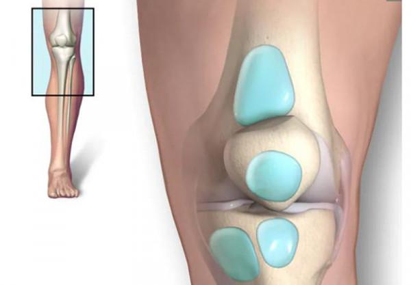 膝蓋沒有受傷，卻莫名其妙的疼痛，最有可能是這4個原因