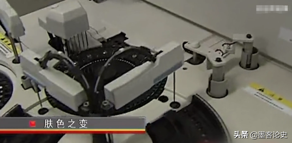 真實故事:山西45歲女子一夜變黑,體重急速增加,手術後讓家人落淚