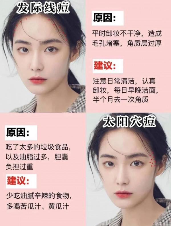 你需要的護膚小知識‘長痘原因’