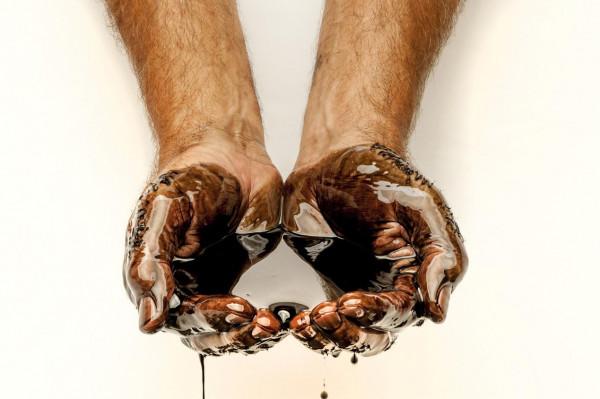 “白血病”專挑孩子下手，家長注意：孩子有5個異常，需及時排查